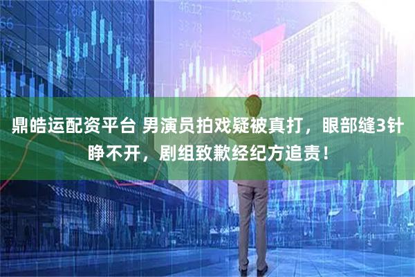 鼎皓运配资平台 男演员拍戏疑被真打，眼部缝3针睁不开，剧组致歉经纪方追责！